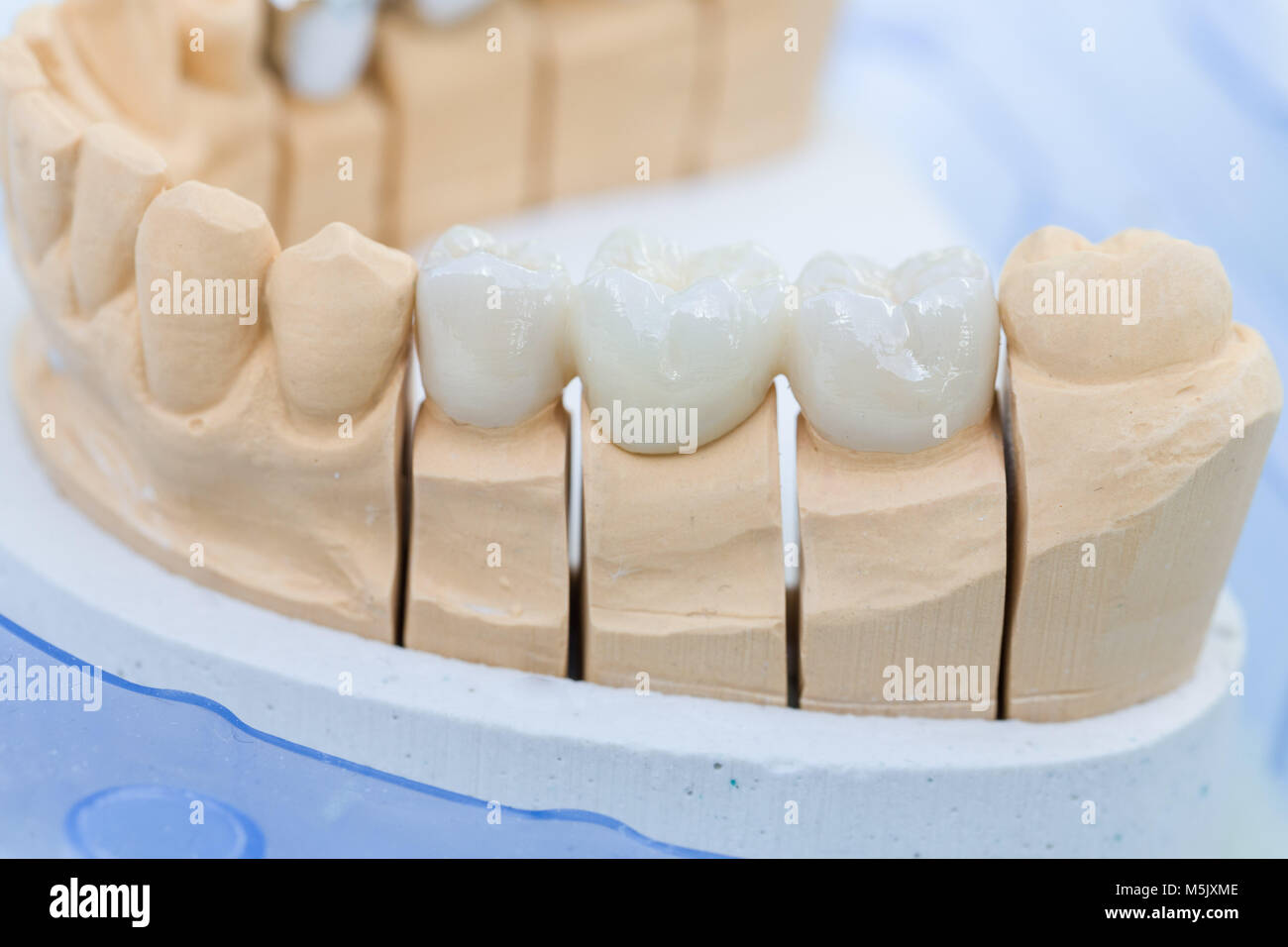 Una protesi sella con dentizione artificiale in un laboratorio odontotecnico Foto Stock
