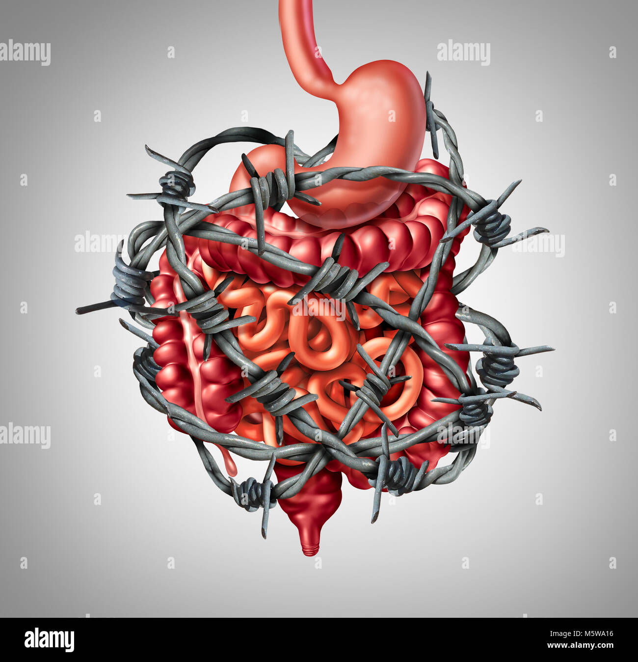 Digestione dolorosa IBS o sindrome da intestino irritabile e intestino dolore o disagio intestinale infiammazione problema o costipazione come filo spinato. Foto Stock