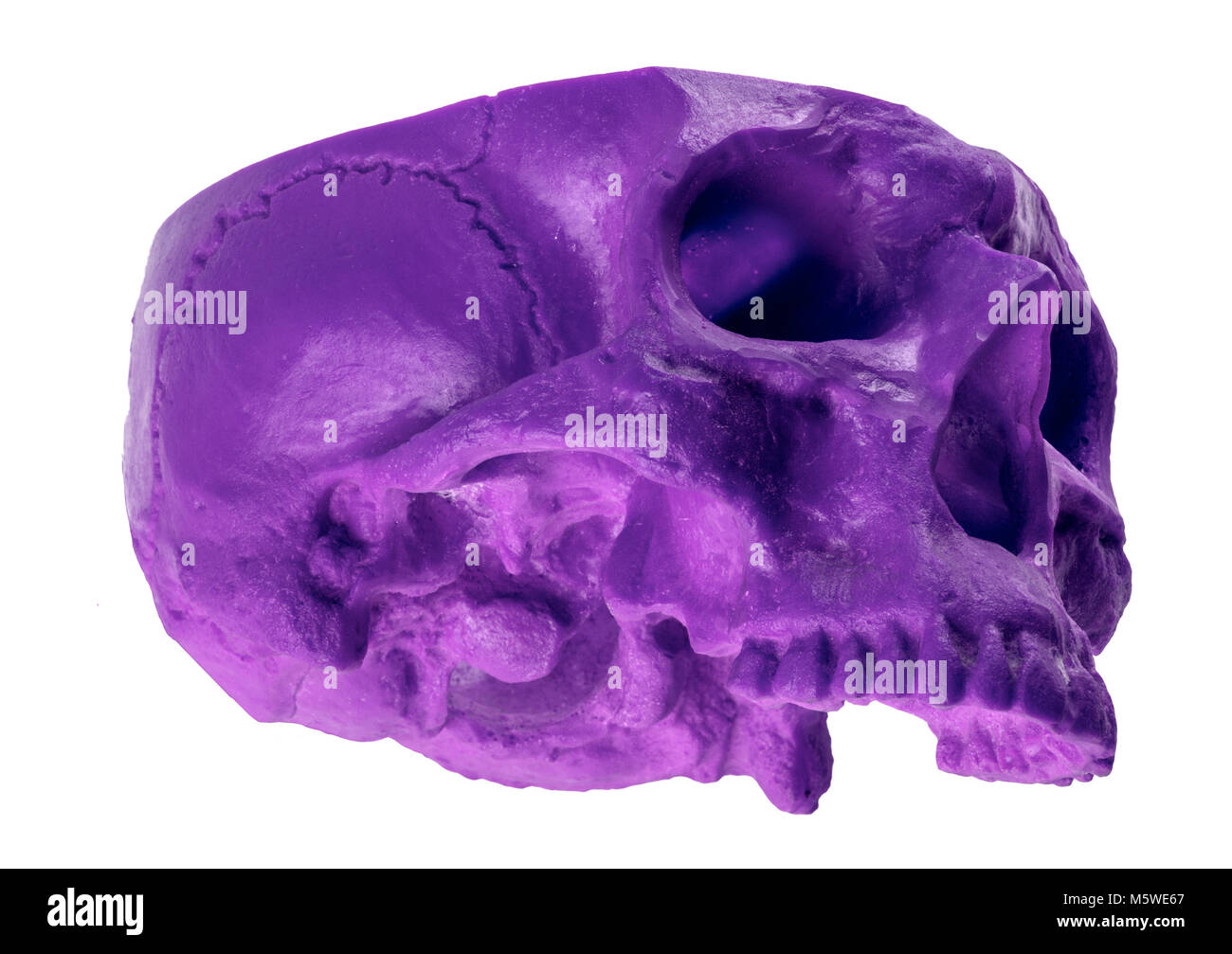 Viola cranio tritato in un insolito angolo cranio mancante Foto Stock