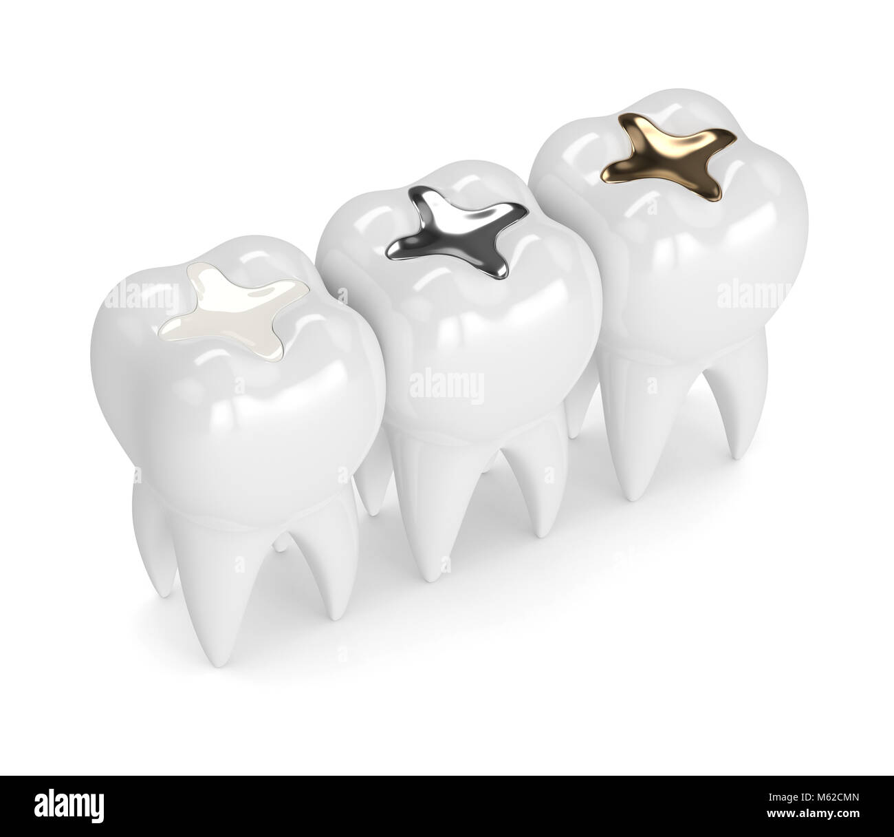 3 Pz Dentale Composo Resina Spatola Di Riempimento Resina K - Foto 3