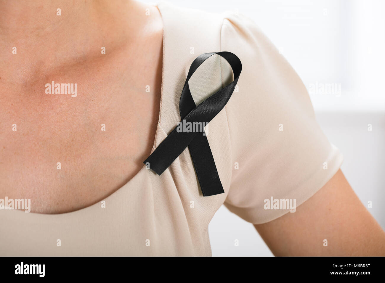 Close-up di una donna con nastro nero per supportare il melanoma della pelle la consapevolezza del cancro Foto Stock