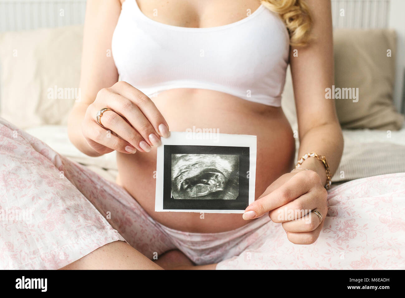 Adulto bella donna incinta. In attesa che il bambino. La gravidanza. Attenzione, la tenerezza, la maternità, parto. Foto Stock