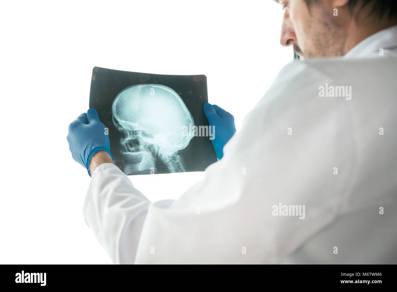 Medico di esaminare ai raggi x il paziente del cranio in una clinica medica. Professionista del healthcare analisi di immagini di test di testa umana. Foto Stock