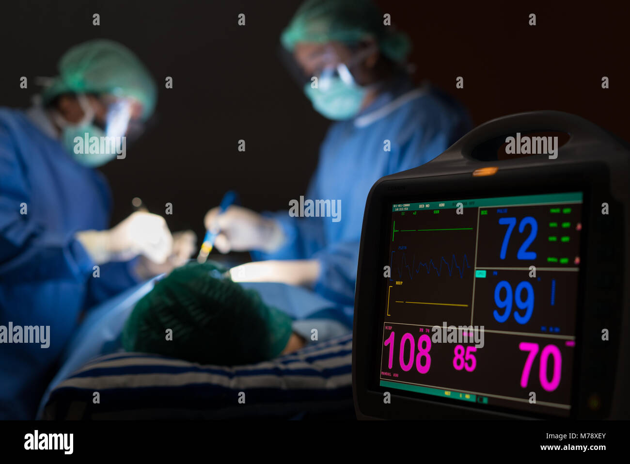 Elettrocardiogramma in ospedale chirurgia di emergenza operativo camera mostra frequenza cardiaca del paziente con blur equipe di chirurghi in background. Salute e medicin Foto Stock