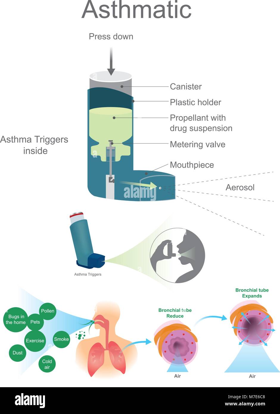 Vie aeree asmatiche includono cellule di fibroblasti di polmone, cellule epiteliali bronchiali e asma bronchiale di cellule del muscolo liscio. Illustrazione Vettoriale