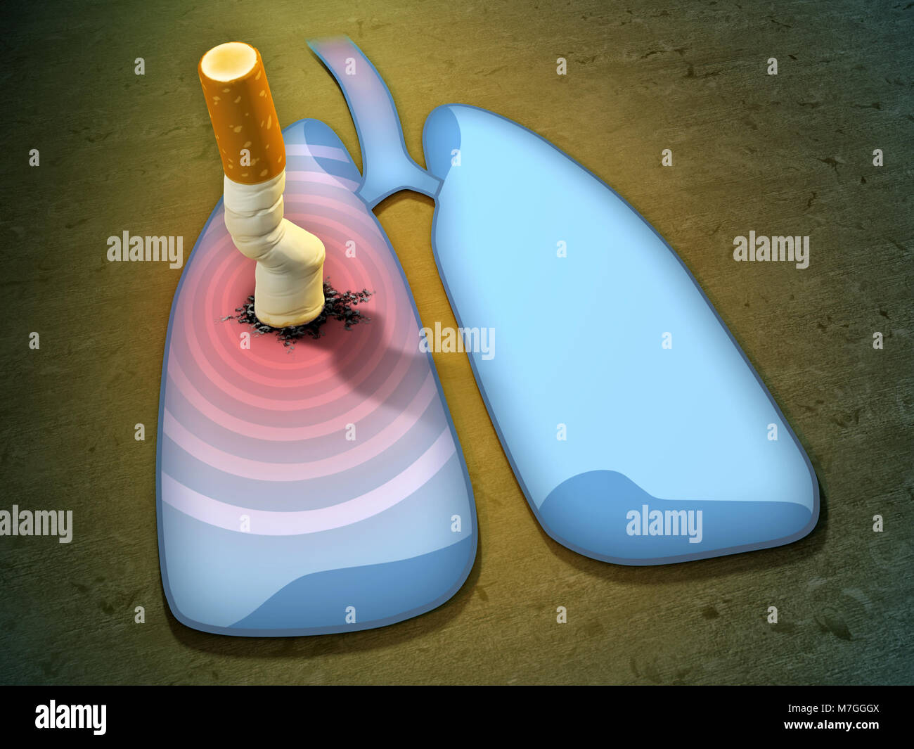 Schiacciato mozzicone di sigaretta causando infiammazione del polmone. 3D'illustrazione. Foto Stock