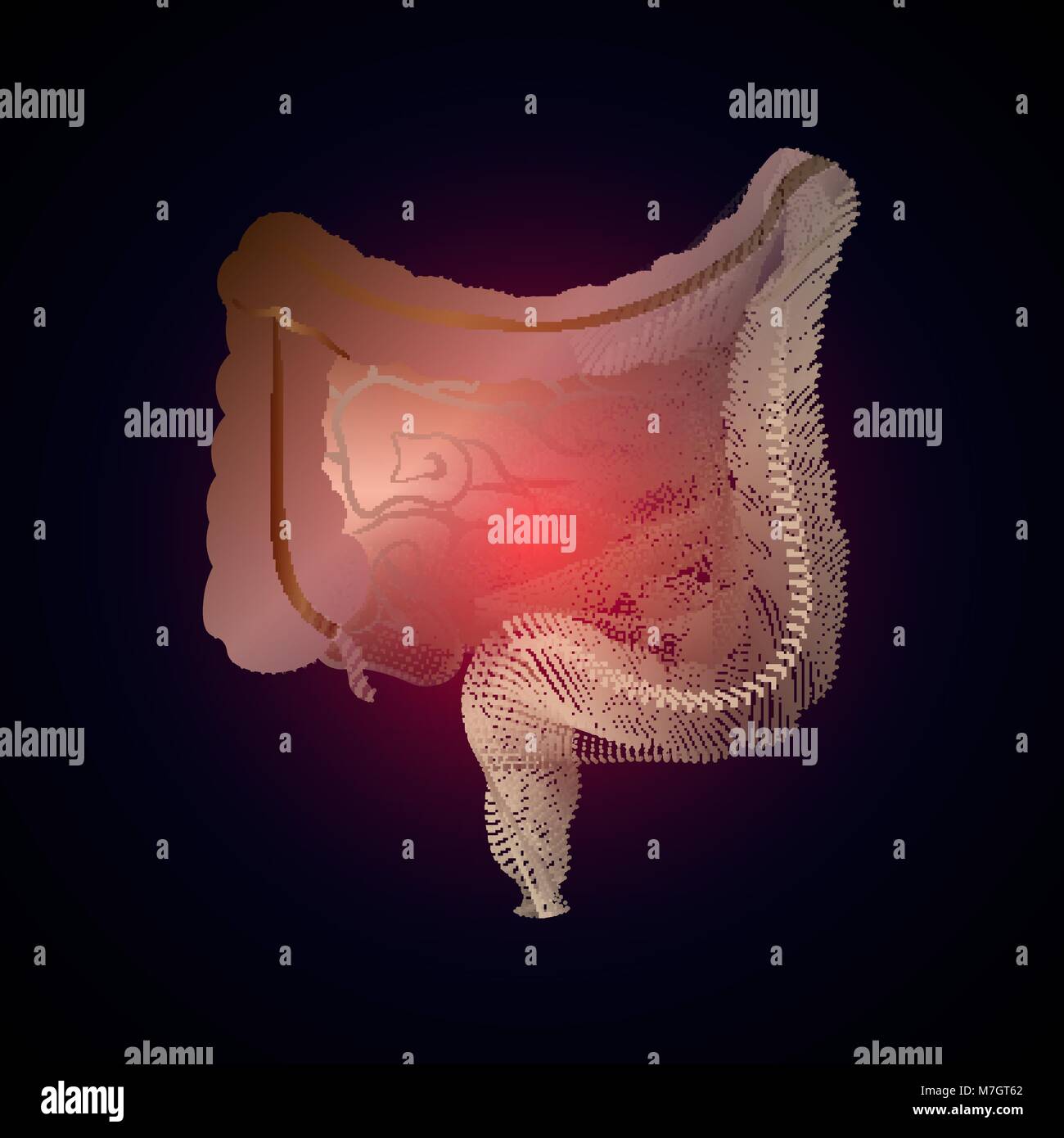 Intestino con un punto di dolore. Stilizzata della transizione da un vero e proprio organo per un X-ray effetto. Illustrazione medica di malattie intestinali. 10 eps Illustrazione Vettoriale
