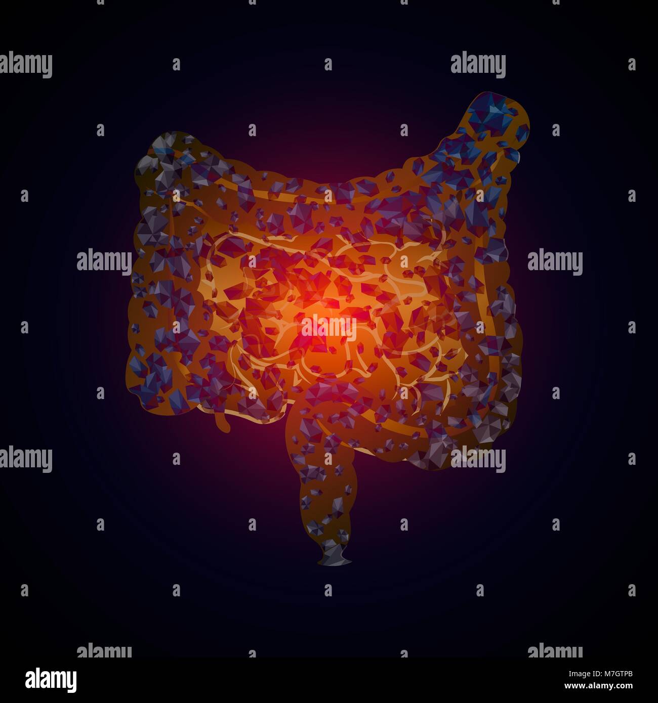 Pesantezza negli intestini. La colite. Illustrazione medica di malattie intestinali. 10 eps Illustrazione Vettoriale