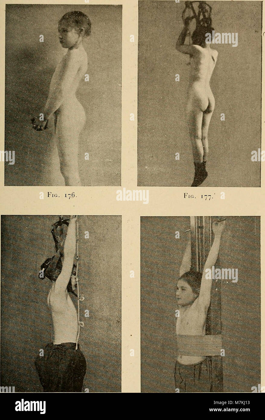 Il manuale di ginnastica ortopedica del 1903 fornisce istruzioni dettagliate sugli esercizi correttivi per il trattamento posturale, con 51 piastre con 209 figure e 53 illustrazioni che dimostrano i movimenti terapeutici. Foto Stock