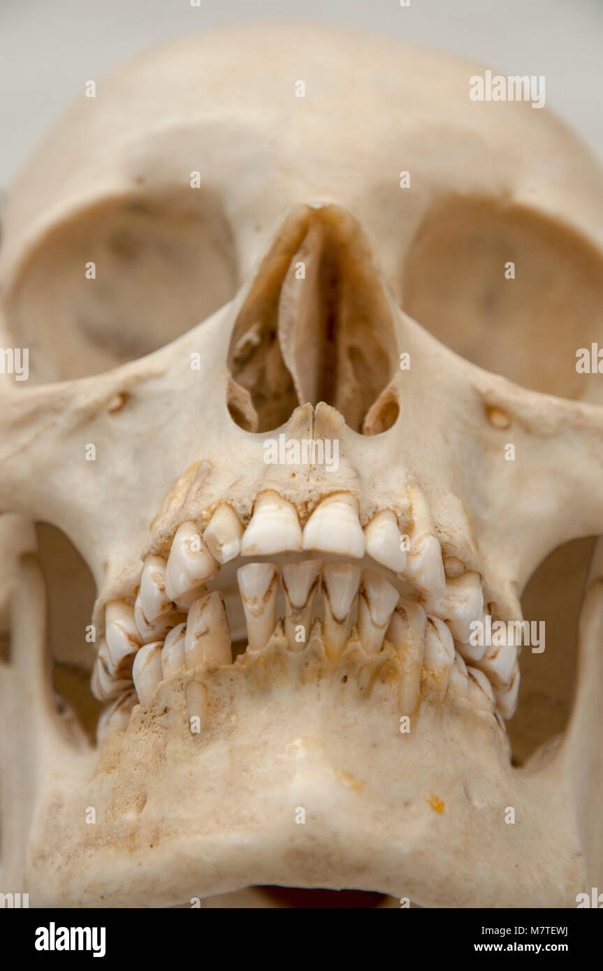 Close up di reale teschio umano il viso a una leggera inclinazione verso l'alto. Utilizzato per medici e studi anatomici. Foto Stock