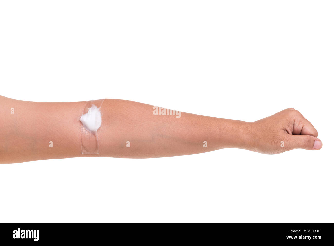 Sul lato sinistro del braccio di donna con cotone bianco dopo la presa campione di sangue isolati su sfondo bianco Foto Stock