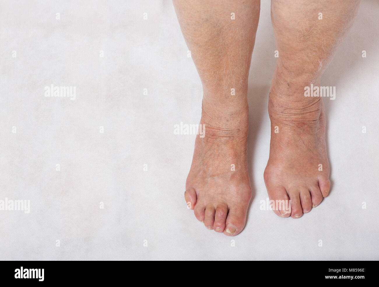 I piedi di una donna senior tra 70 e 80 anni Foto Stock