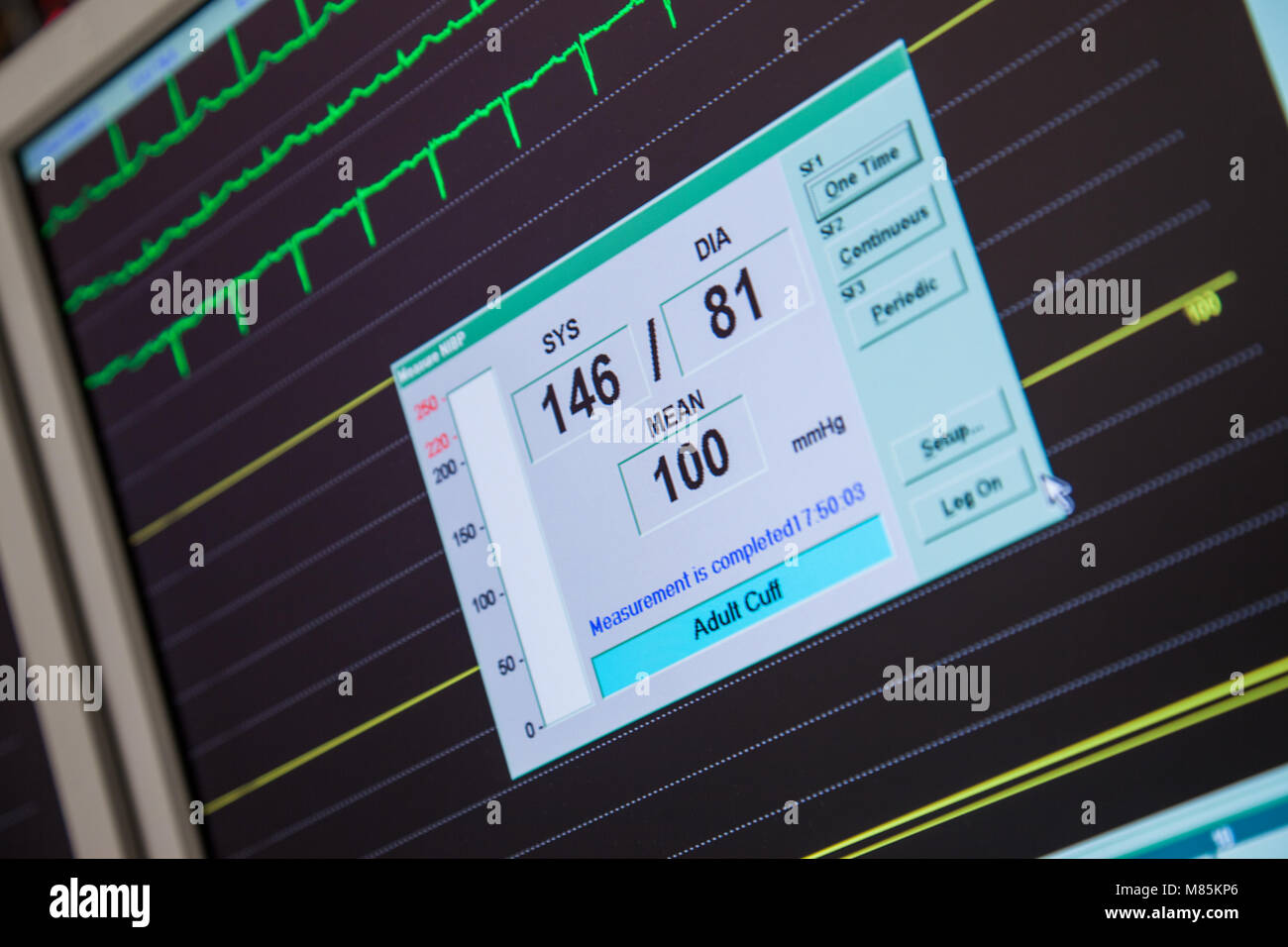 La pressione sanguigna Monitor per la frequenza cardiaca Foto Stock