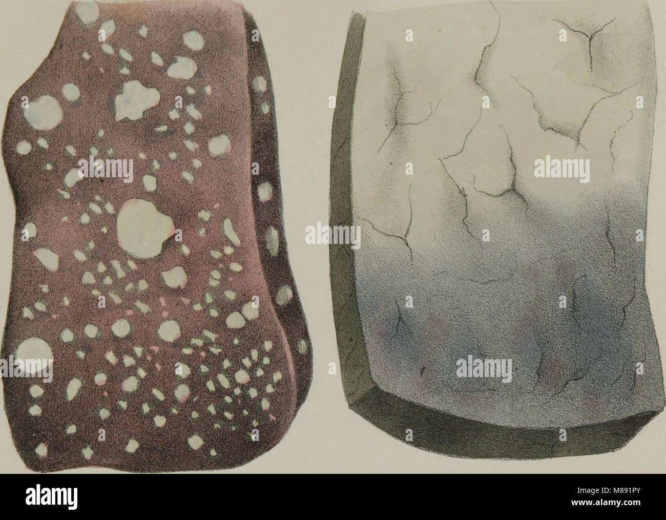 Elementi di anatomia patologica (1845) (14780541284) Foto Stock