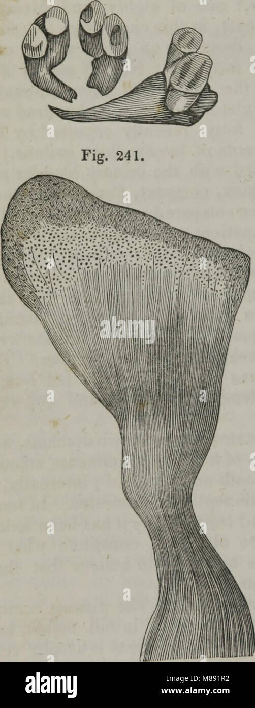 Elementi di anatomia patologica (1845) (14782665482) Foto Stock