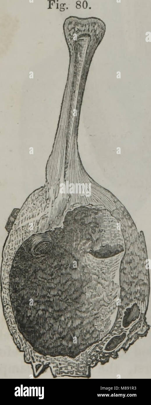 Elementi di anatomia patologica (1845) (14802780413) Foto Stock