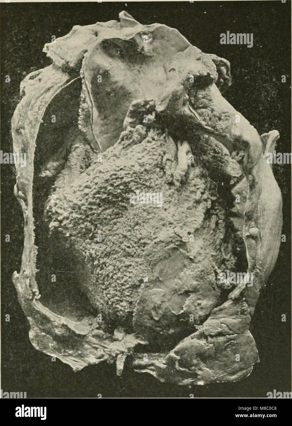 Malattie del torace e i principi della diagnosi di fisica (1920) (14593533658) Foto Stock