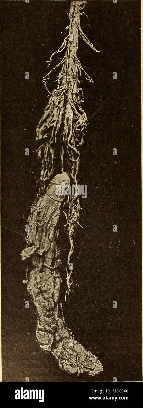 Malattie del sistema nervoso (1908) (14779387062) Foto Stock