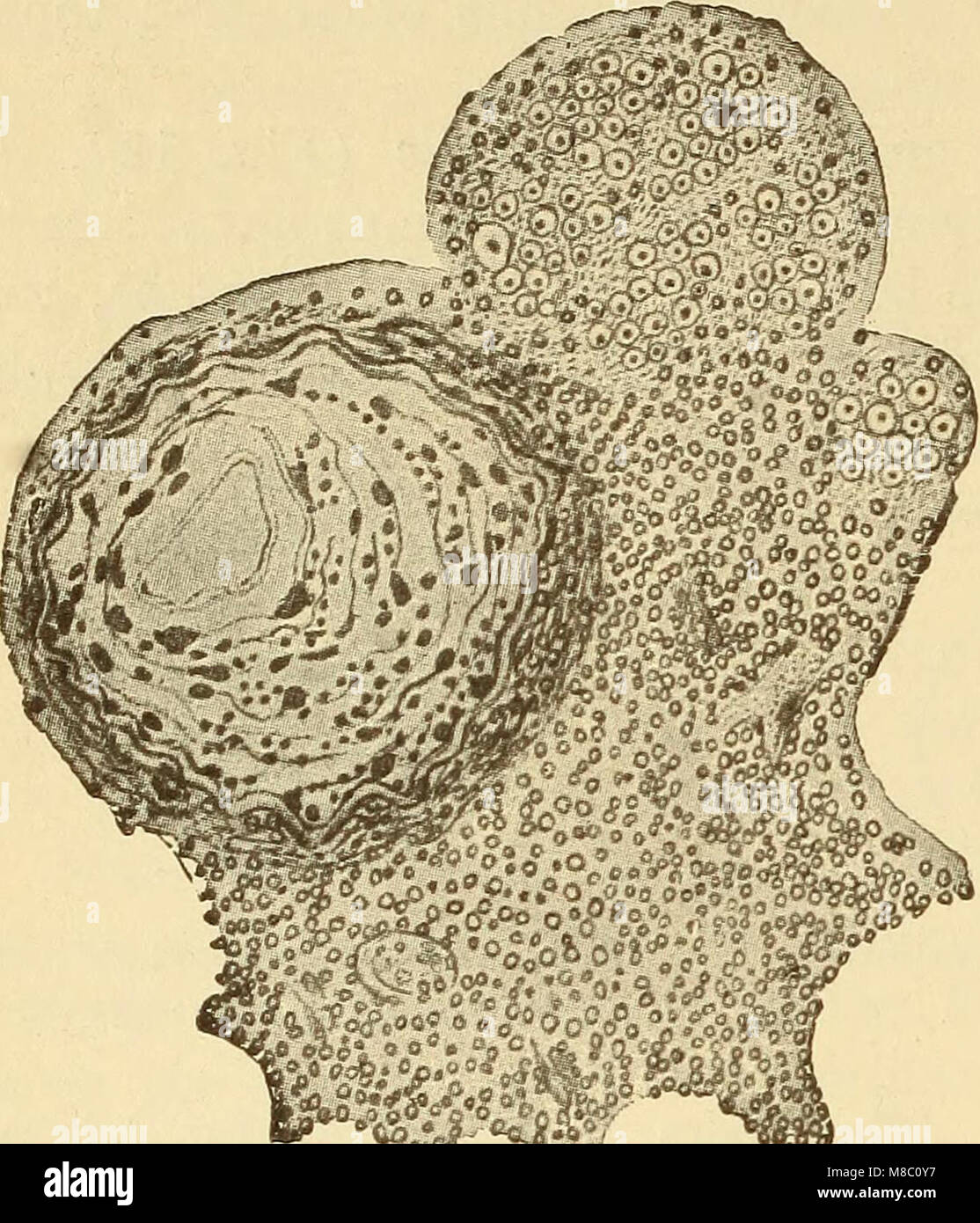 Questa pubblicazione del 1910 esplora varie malattie che colpiscono il sistema nervoso, compresi i disturbi neurologici, i loro sintomi e le opzioni di trattamento disponibili al momento. Il testo fornisce approfondimenti sulla comprensione medica precoce della neurologia e sulle sfide nella diagnosi e nel trattamento delle condizioni del sistema nervoso. Foto Stock