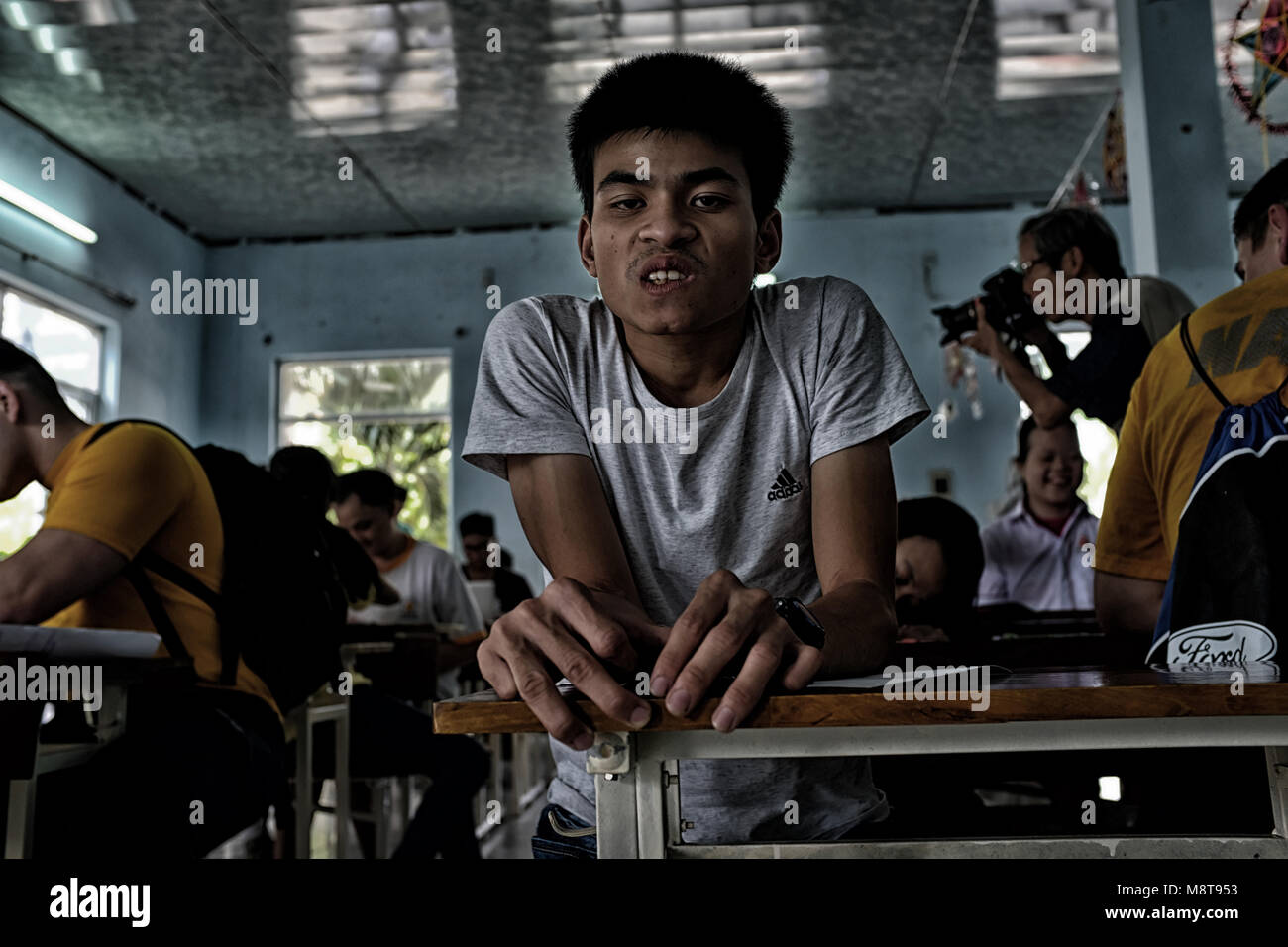 Agente Orange vittime in Vietnam Foto Stock