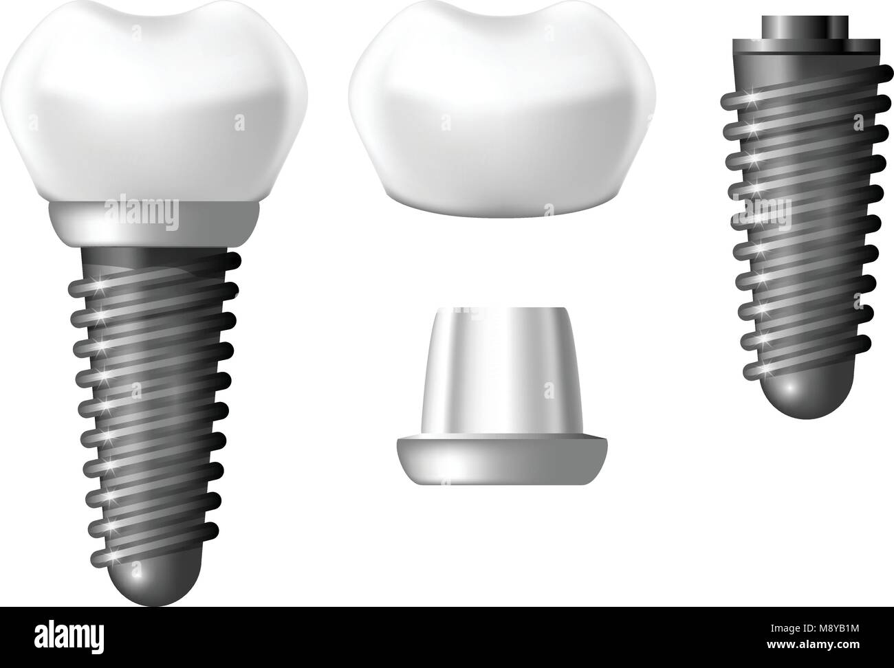 Componenti di impianto dentale - Denti di dentiera Illustrazione Vettoriale