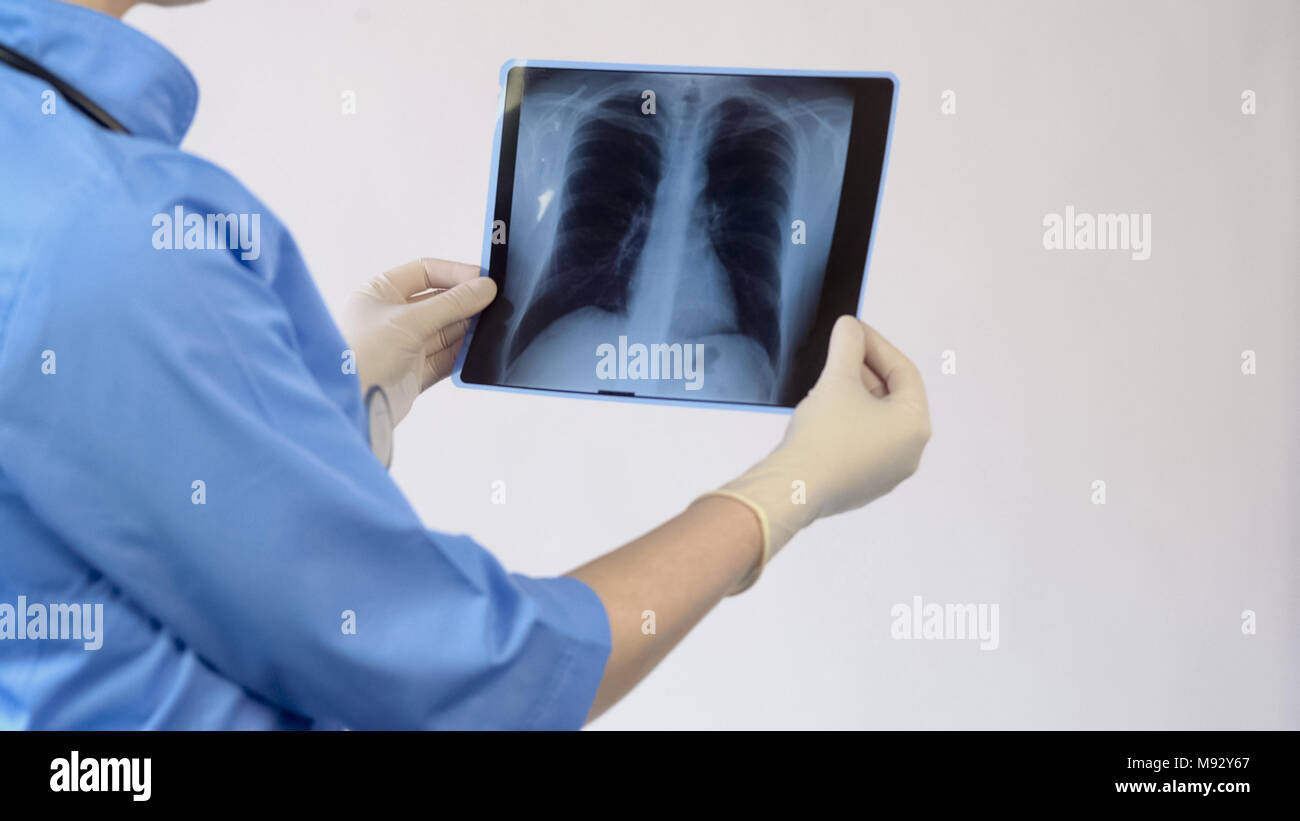 Terapista del sesso femminile analizzando i polmoni x-ray, esame paziente risultato, la diagnosi Foto Stock