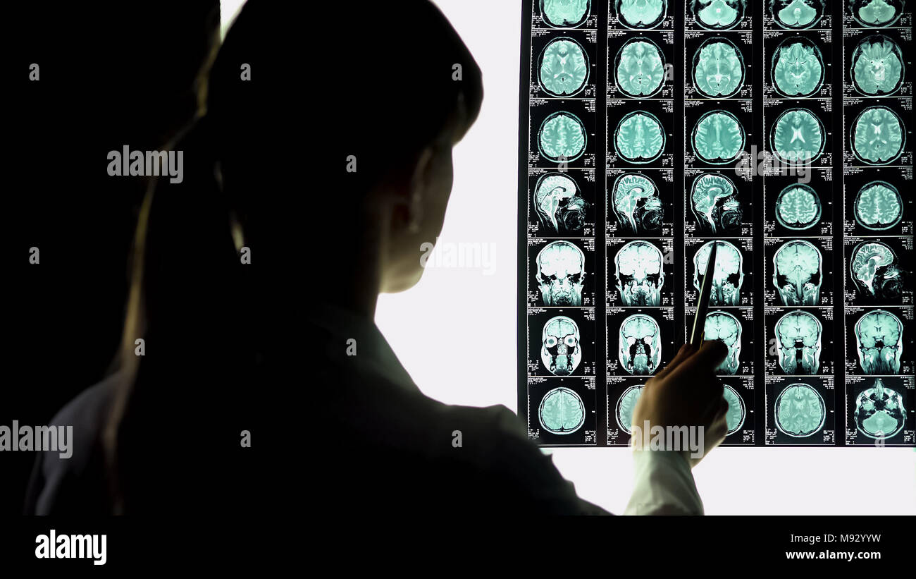 Neurochirurgo analizzando il cervello x-ray, vasi sanguigni, problemi di malattia incurabile Foto Stock
