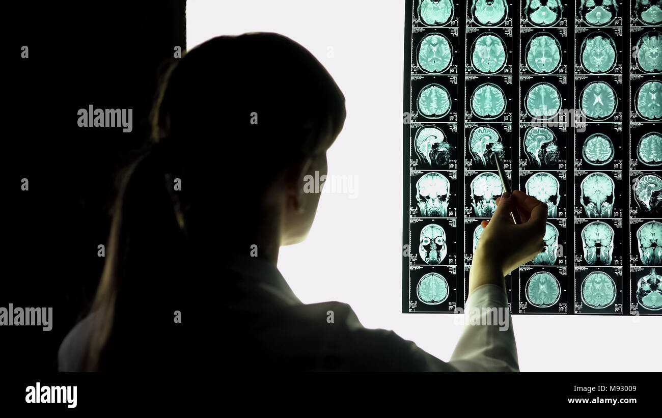 Neurochirurgo guardando al cervello del paziente x-ray, immagine di puntamento, ospedale di internship Foto Stock