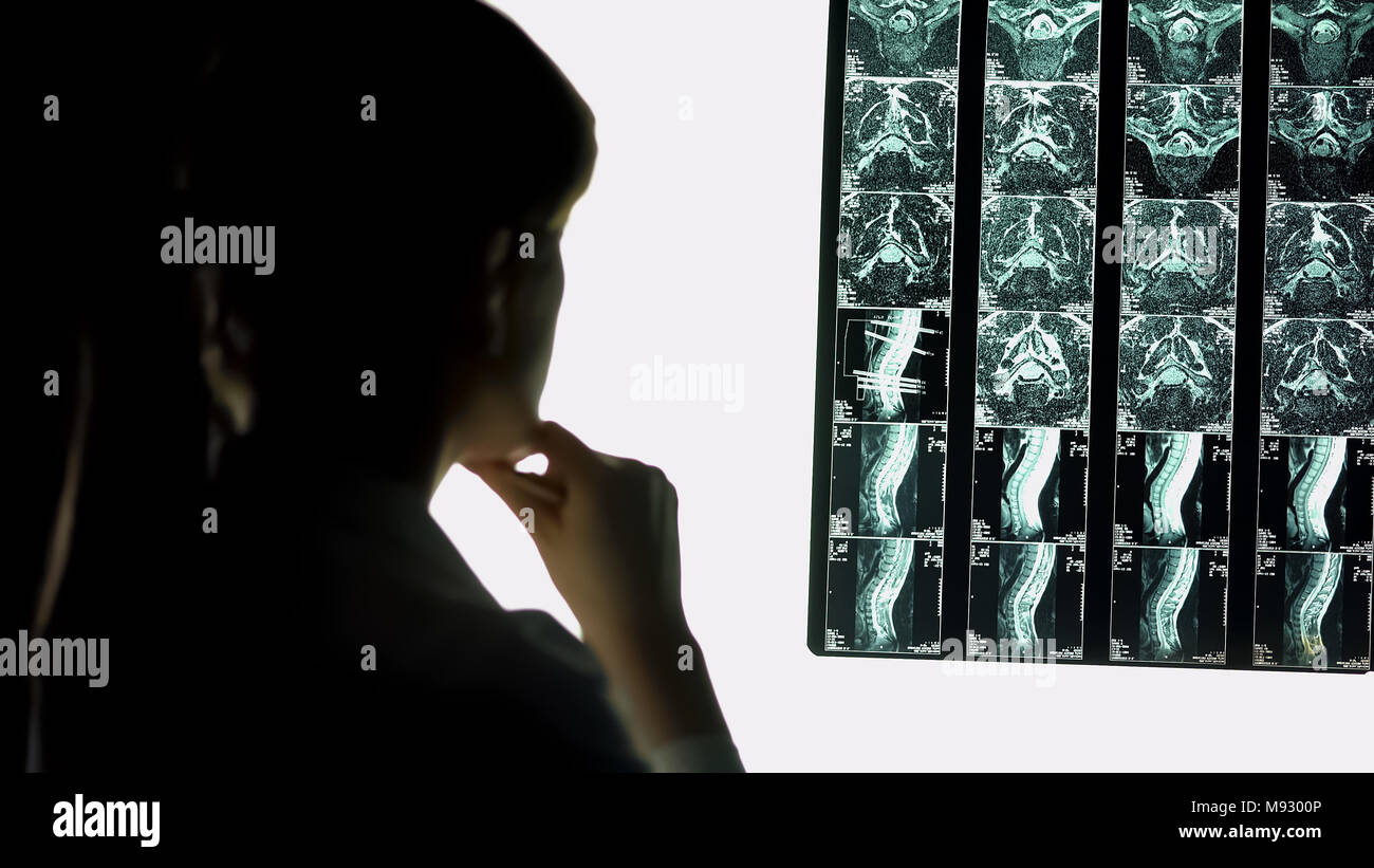 Medico paziente analisi di immagine di scansione, la diagnosi di eventuali problemi con la schiena, raggi x Foto Stock