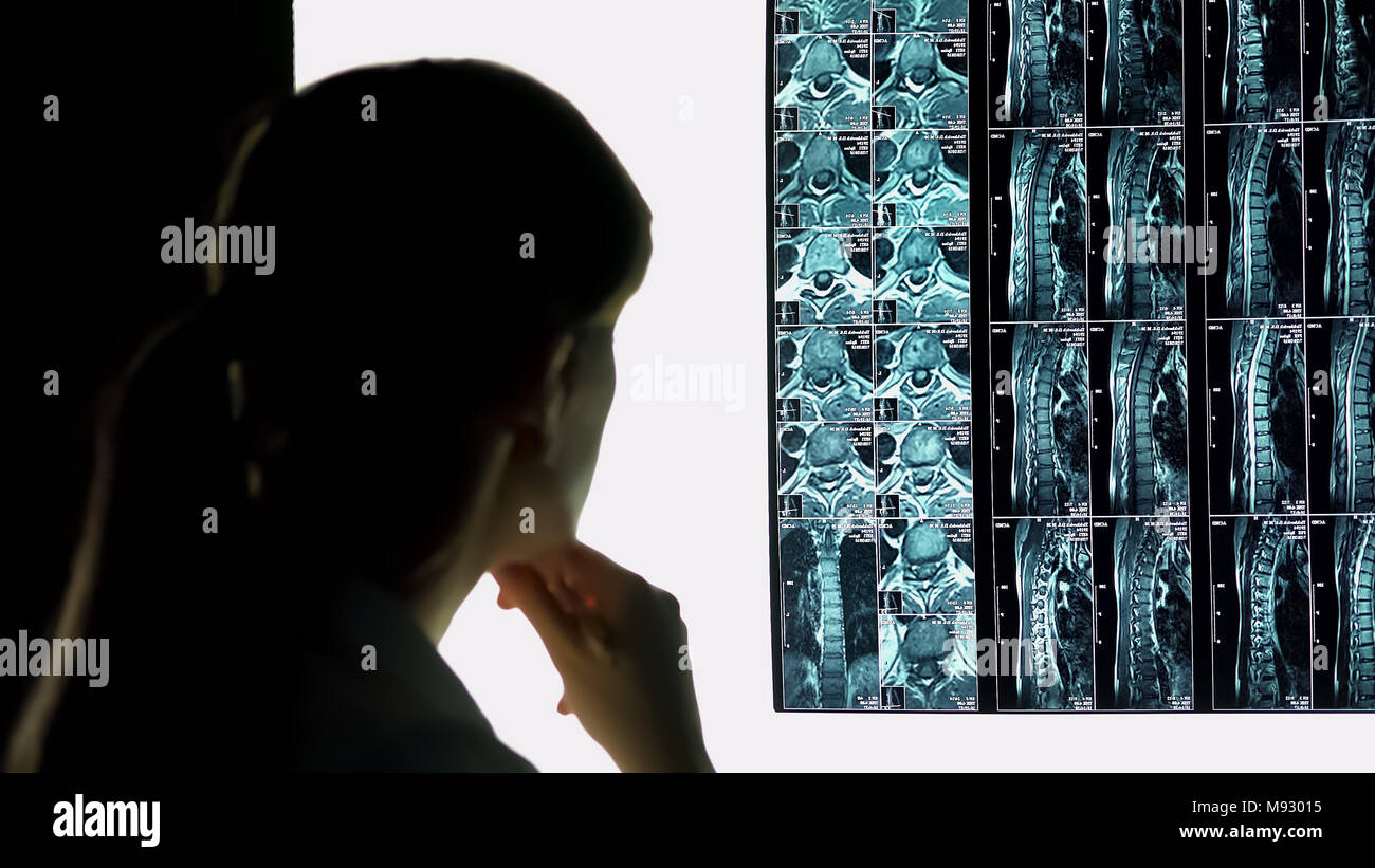 Ospedale intern controllo pazienti x-ray, lesioni del midollo spinale alla diagnosi e al trattamento Foto Stock