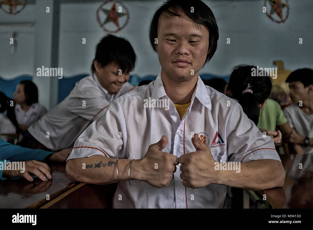 Agente Orange vittime in Vietnam Foto Stock