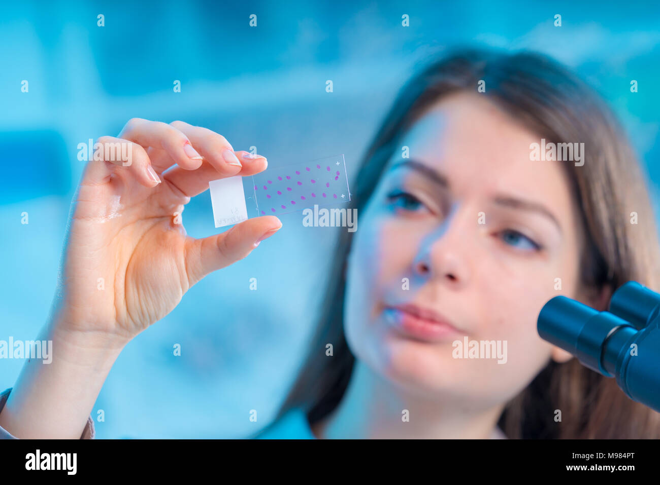 Campione di sangue sul vetrino del microscopio. Ricercatore analizzando vetrino del microscopio Foto Stock