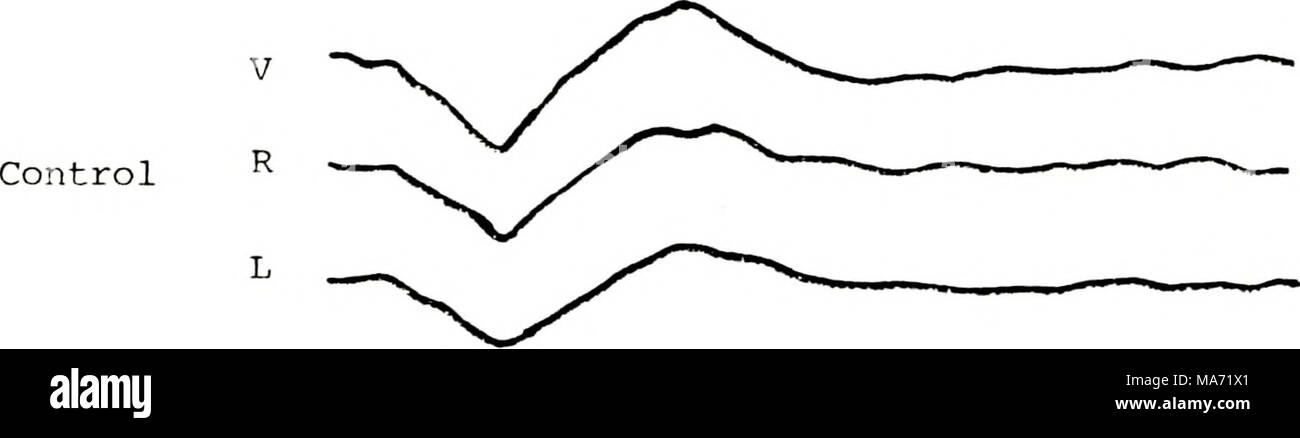 . Effetti della trasformazione fonetica e stimolo pertinenza su apparato uditivo risposta evocata. . 100 ms in figura 1. Media di potenziali evocati per CVj  stimolo registrato dal vertice (V), sinistra (L) e destro (R) temporo-siti parietali durante varie condizioni. Ogni potenziale è un com- posite di otto soggetti. Taratura = 10 µv. Foto Stock