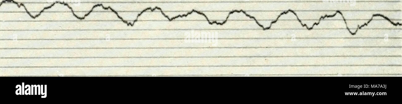 . Microscopia elettronica; il procedimento della Conferenza di Stoccolma, Settembre, 1956 . Abb. 6. EM-Aufnahme von jodiertem Fichtenzellstoff(Faser- tracheide) mit Photometerkurve. Vergr. 120 000 â'. LiTERATUR 1. AssAF, A. C, Haas, R., und Purves, C. B., /. Am. Soc. 66, 59(1944). 2. Clark, G. L. und Parker, E. A., Science 85, 203 (1937). 3. Grasmann, W., Hofmann, U., und Nemetschek, Th., Z. Natiirforsch. 7 b. 509 (1952). 4. Harris, H. A. und Purves, C. B., carta commercio J. 110, 29 (1940). 5. Hess, K., /. Colloid Sci. Suppl. 1, 143 (1954). 6. Hess, K. und Kiessig, H., Naturwiss. 31, 171 (1943). 7. Â Z Foto Stock