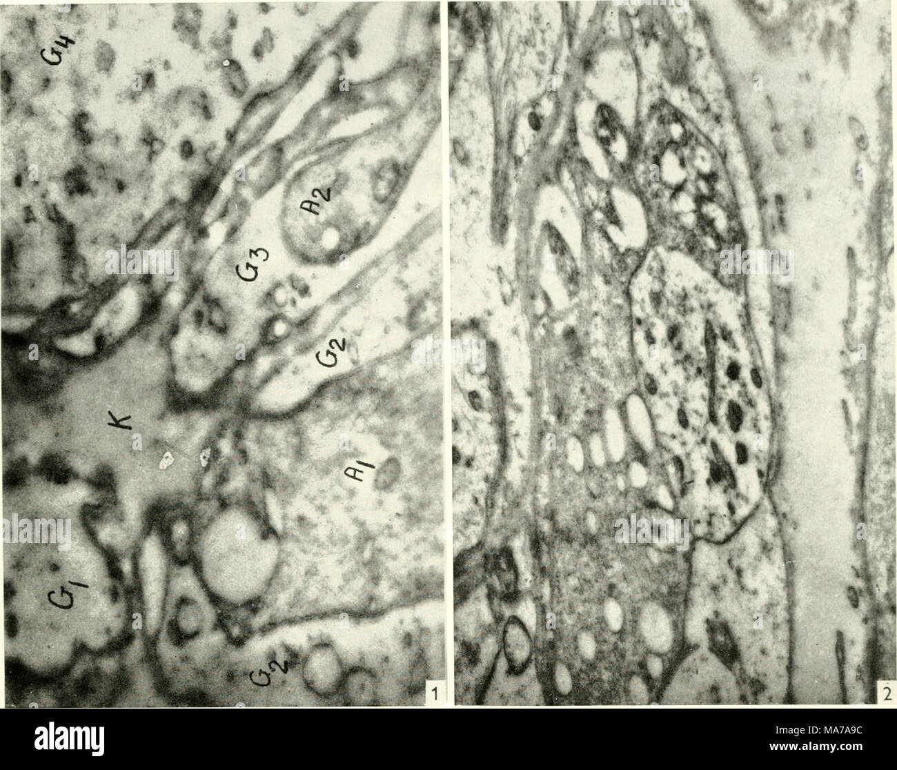 . Microscopia elettronica; il procedimento della Conferenza di Stoccolma, Settembre, 1956 . Abb. 1. Mehrere Gliazellanschnitte (G). In der Milte oben Knotenpunkt (K) eines exirazelluliiren Kanalsystems, dessen feinere Auslaufcr zwischen und in den Gliazellen eine homogene Grundsubstanz enthalten. Links iinten ein Axon (Al), das durch Auseinanderschieben des Mesaxon eine breite Kontaktflache zum Extrazellular-Raiim herstellt. Rechts unten eine weitere Nervenfaser (A2), die auBer Mesaxon dem noch ein bis un das Axon heranreichendes Kanai- chen erkennen liiBt. VergroBerung: 25 000 Abb. 2. Zwei direkt anein Foto Stock
