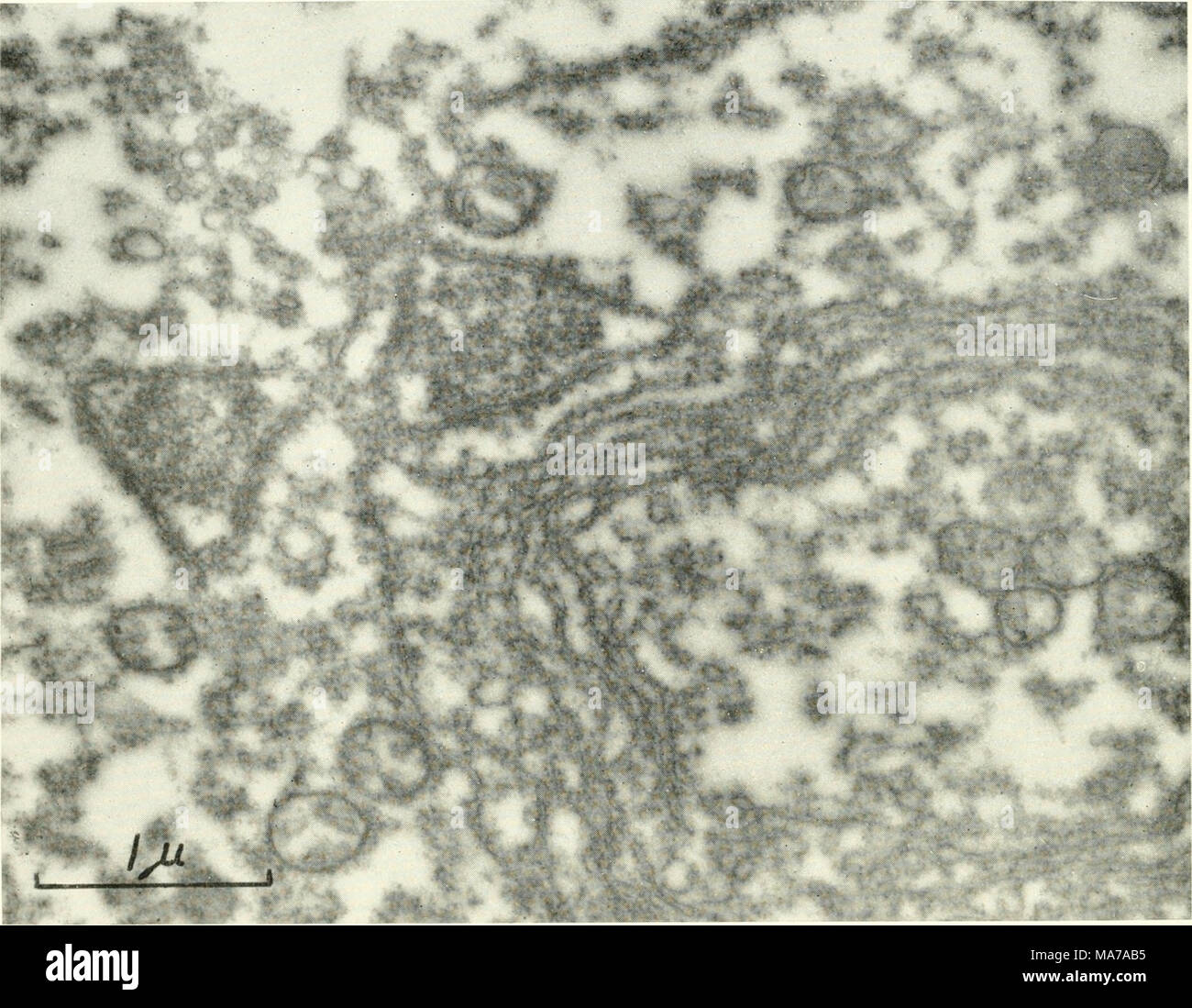 . Microscopia elettronica; il procedimento della Conferenza di Stoccolma, Settembre, 1956 . Fig. I. i due RNA-contenenti i corpi di dimensioni microscopiche nel citoplasma delle uova possono essere confrontati in questa immagine. Una porzione di un "nucleo di tuorlo" con una-cytomembranes racchiudente un paio di mitocondri è visto alla destra e due triangolare di corpi pesanti a sinistra di questa inclusione. La foto viene dal mare urchin specie Styungy/ocentroriis droehacliiensis. Ingrandimento â 30.000. chondria non erano o molto debolmente colorato mediante questa tecnica. Un altro componente di cella che colorate con RNA-sta specifici Foto Stock