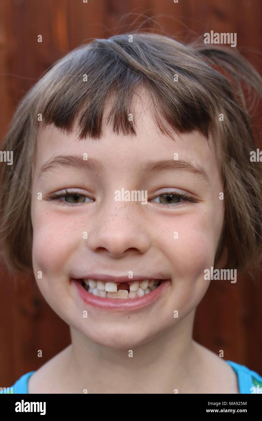 Close up di un vertiginoso bambina che ha appena perso un dente Foto Stock