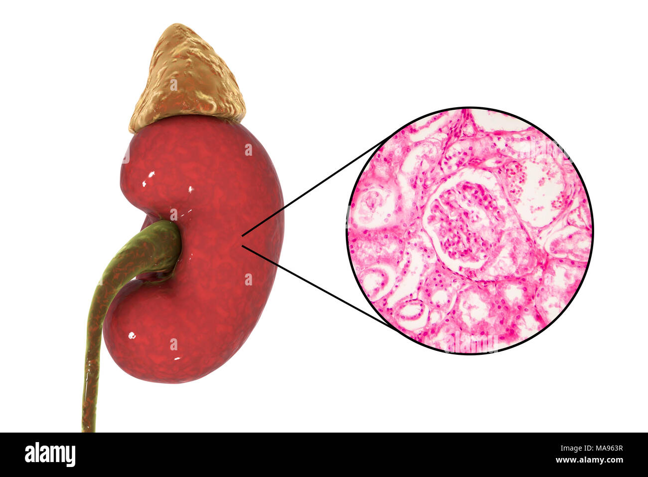 Illustrazione di rene umano e luce micrografia di una sezione di una corteccia renale che mostra un glomerulus (rotondo). Un glomerulus fa parte del rene di unità funzionali, Nephron, che sono circa un milione in un rene. Un glomerulus è avvolto strettamente rete di capillari. Come il sangue passa attraverso di esso, acqua e scorie metaboliche sono filtrati attraverso le pareti del capillare. Il filtrato è stato poi scarichi per la la capsula di Bowman lumen (bianco) che circonda il glomerulus. Dalla capsula, il filtrato passa nei tubuli dove la maggior parte dell'acqua viene riassorbito. Foto Stock