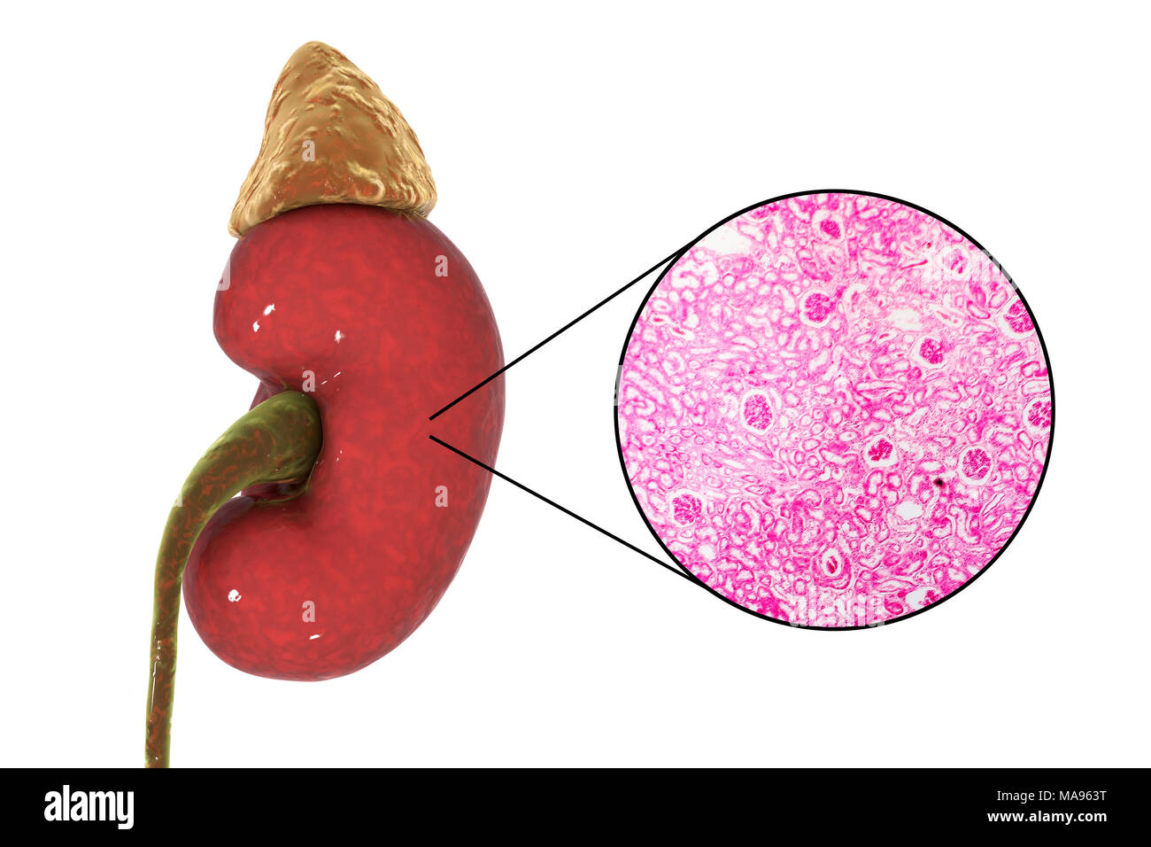 Illustrazione di rene umano e luce micrografia di una sezione di una corteccia renale che mostra i glomeruli (rotondo piccolo). Un glomerulus fa parte del rene di unità funzionali, Nephron, che sono circa un milione in un rene. Un glomerulus è avvolto strettamente rete di capillari. Come il sangue passa attraverso di esso, acqua e scorie metaboliche sono filtrati attraverso le pareti del capillare. Il filtrato è stato poi scarichi per la la capsula di Bowman lumen (bianco) che circonda il glomerulus. Dalla capsula, il filtrato passa nei tubuli dove la maggior parte dell'acqua viene riassorbito. Foto Stock