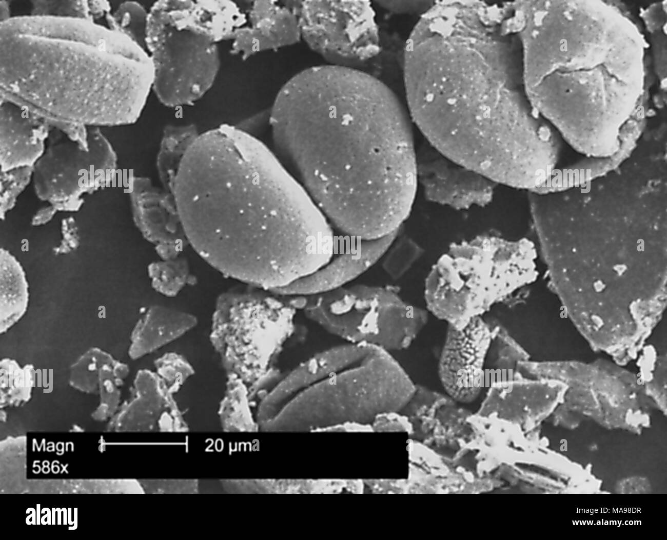 Array morfologiche di granuli di polline rivelato nella microfotografia film, centri per il controllo delle malattie (CDC) campus, Atlanta, Georgia, 2004. Immagine cortesia centri per il controllo delle malattie / Janice Haney Carr. () Foto Stock