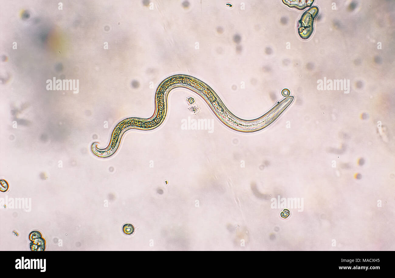 Toxocara canis secondo stadio larve hatch da uova nel microscopio. Toxocariasis, noto anche come nematode infezione, provoca la malattia negli esseri umani Foto Stock