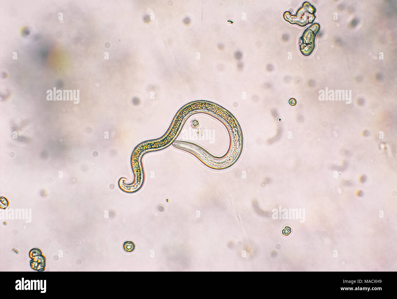Toxocara canis secondo stadio larve hatch da uova nel microscopio. Toxocariasis, noto anche come nematode infezione, provoca la malattia negli esseri umani Foto Stock