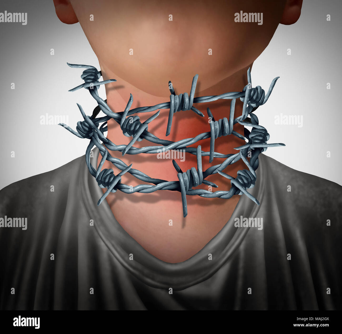 Mal di gola dolore concetto medico come un collo umano avvolta con filo spinato come un doloroso problema sanitario simbolo in un 3D illustrazione dello stile. Foto Stock