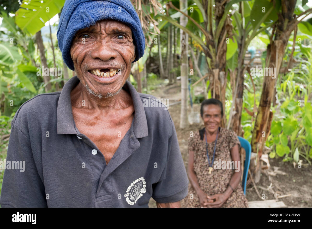 HealthcareA marito e moglie nel villaggio di Kasait, Liquica, Timor Leste . A causa di una mancanza di infrastrutture in montagna, l'accesso alle cure sanitarie è difficile per gli abitanti del villaggio e vi è una diffusa malnutrizione. Questo uomo è anche perdendo i suoi denti, a causa del fatto non vi sono impianti dentali. Foto Stock