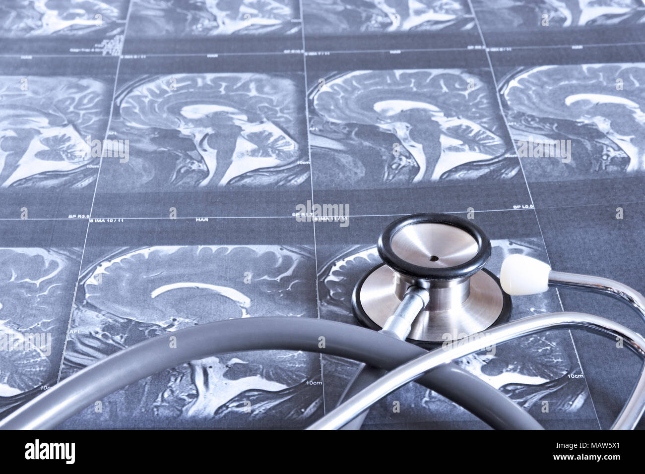 Vista prospettica di MRI scan del cervello umano (vista sagittale) e uno stetoscopio Foto Stock