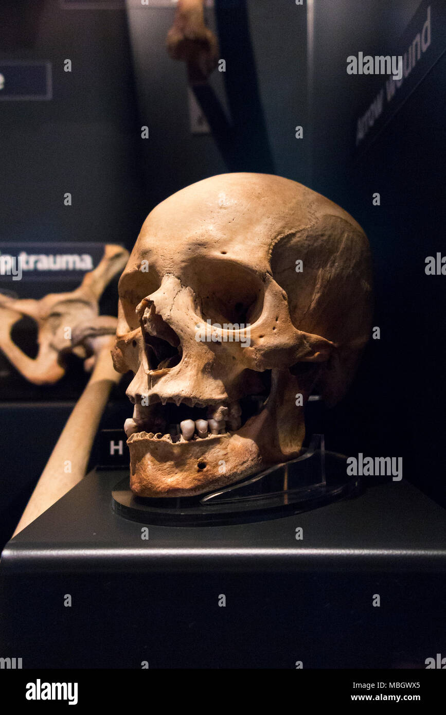Cranio umano dal relitto della Mary Rose; nave da guerra di inglese Tudor marina del re Henry VIII Il Mary Rose Museum, Historic Dockyard, Portsmouth. Regno Unito Foto Stock