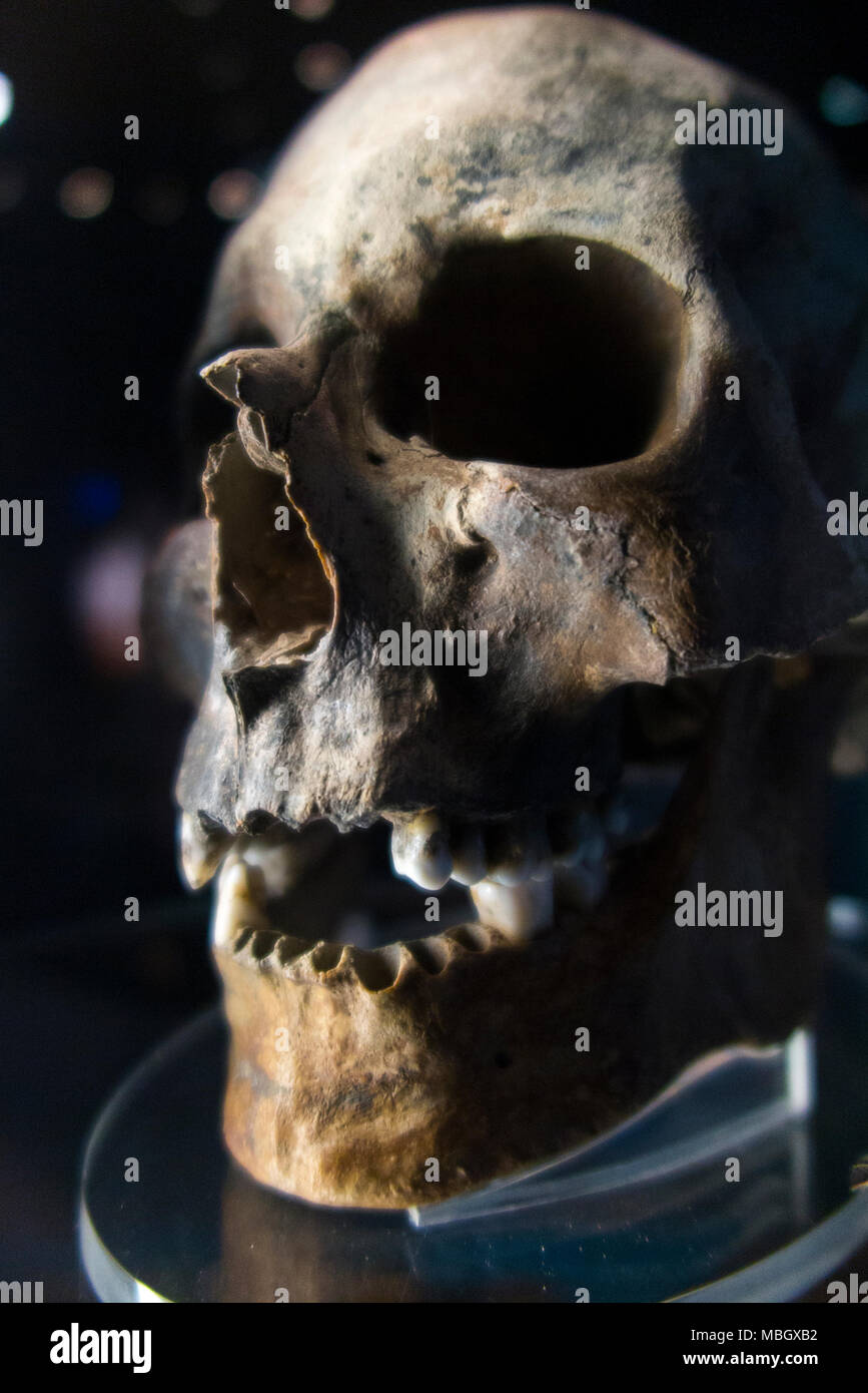 Cranio umano dal relitto della Mary Rose; nave da guerra di inglese Tudor marina del re Henry VIII Il Mary Rose Museum, Historic Dockyard, Portsmouth. Regno Unito Foto Stock