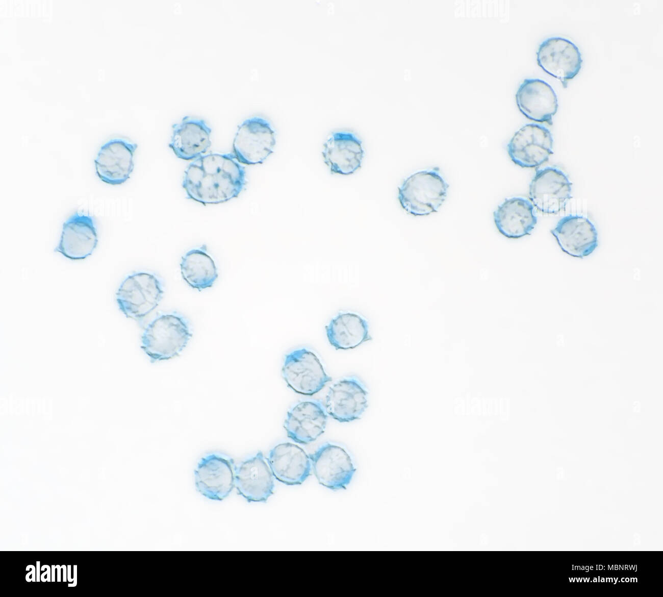 Micrografia luce di Lactarius rubrilacteus (spurgo) milkcap spore di funghi, il campo di vista è di circa 0,11mm di larghezza Foto Stock