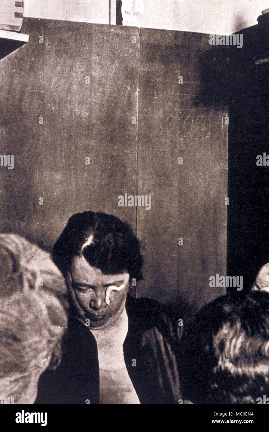 I fenomeni psichici che - Teleplasm o ectoplasm, apparentemente emergenti dall'occhio o nelle narici del mezzo. Fotografato il 23 settembre 1928, a Winnipeg, Canada. Vi è anche un cavo verticale proiezione, che suona un campanello durante la seance Foto Stock