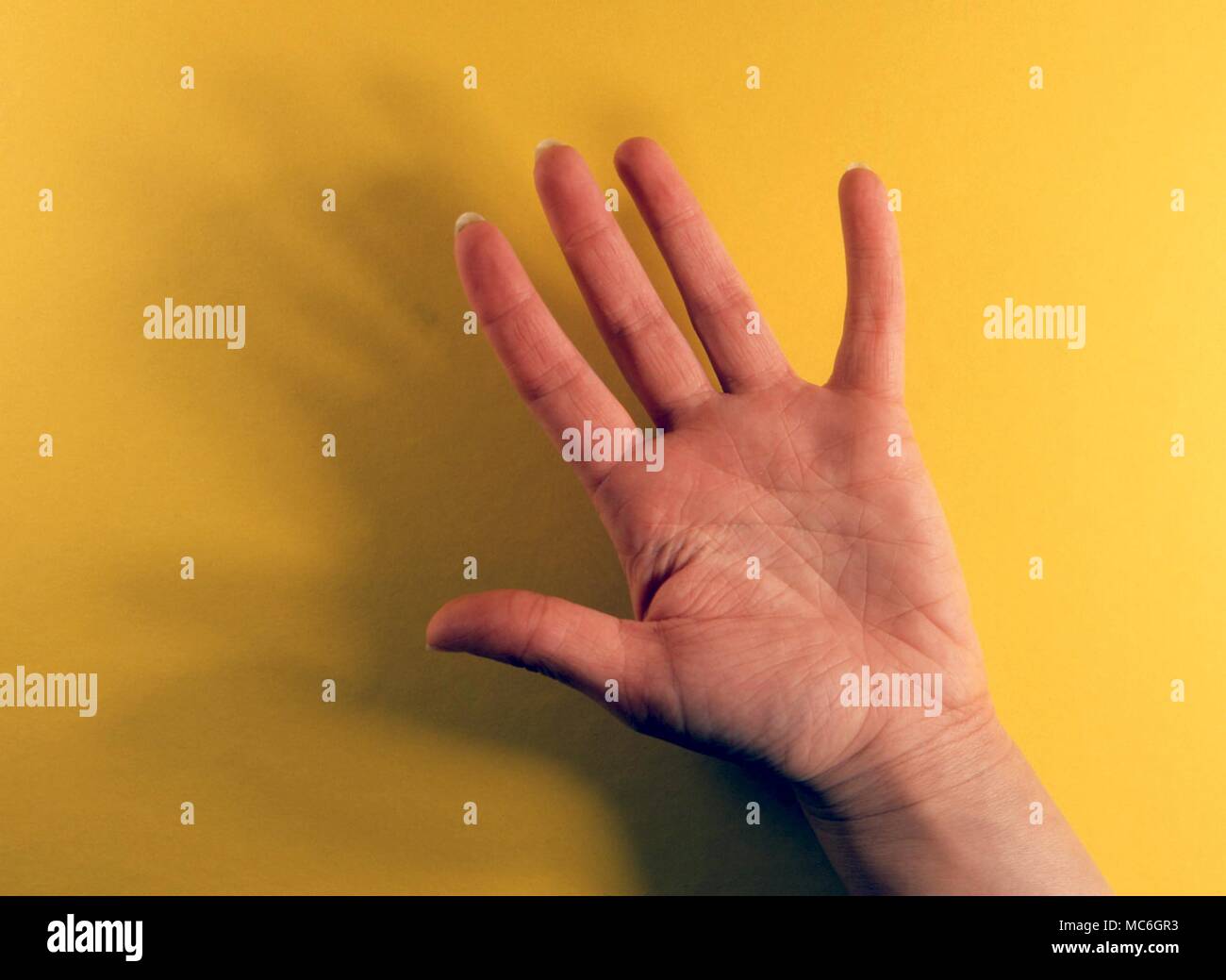 Chiromanzia - Un esempio di una femmina di mano del tipo acqua (la cosiddetta sensibile mano) con lunghi palm e denti lunghi Foto Stock